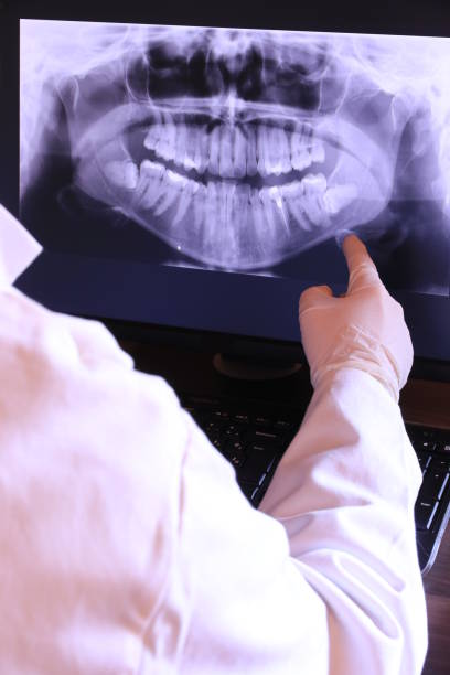 Best Emergency Treatment for Dental Infections or Abscesses in Augusta, AR