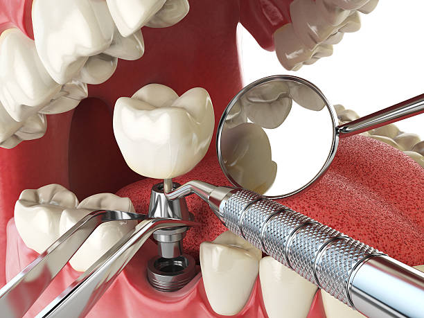 Best Weekend Emergency Dentist in Augusta, AR