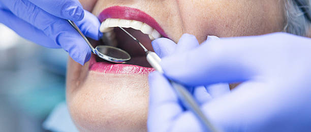 Best Emergency Wisdom Teeth Removal in Augusta, AR
